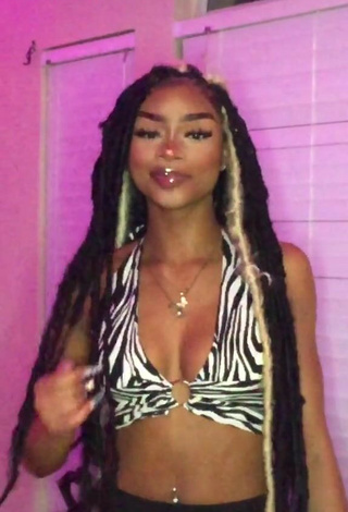 3. Beautiful Ffrenchieeee Shows Cleavage in Sexy Zebra Crop Top